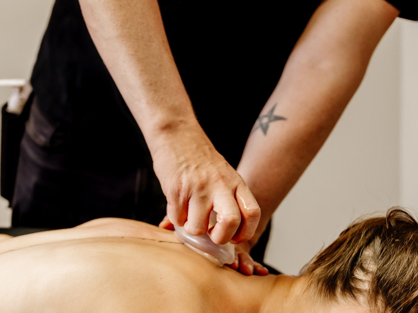 Cupping therapy in progress, a silicone cup applied to the upper back.