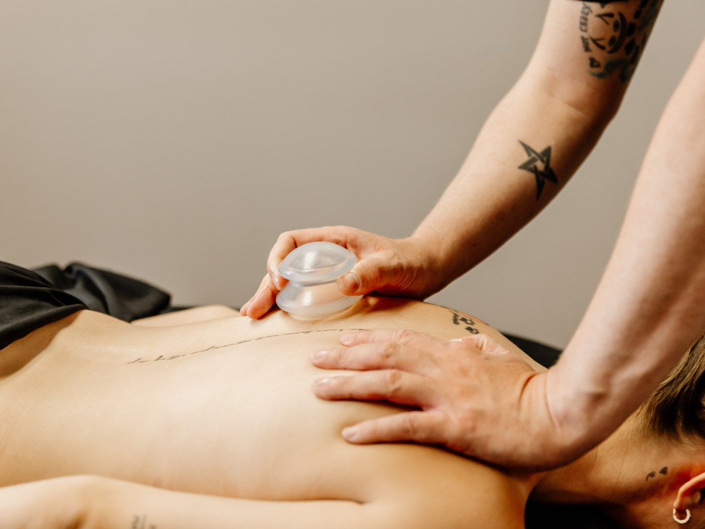Cupping therapy in progress, a silicone cup applied to the upper back.