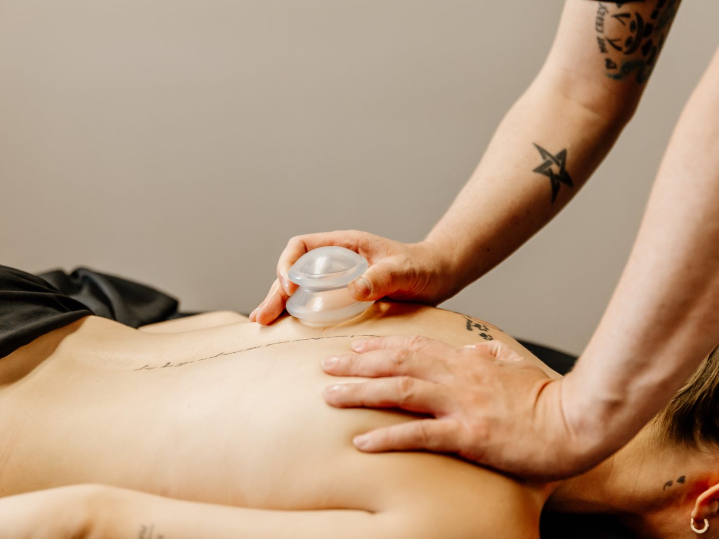 Cupping therapy in progress, a silicone cup applied to the upper back.